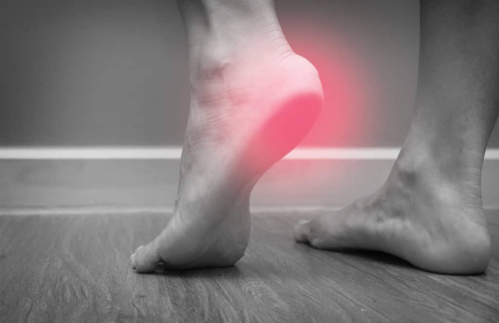 Plantar Fasciitis and Physical Therapy 