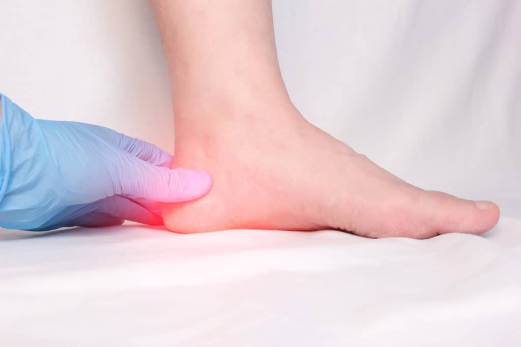 How To Treat Plantar Fasciitis